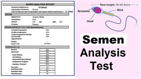 how to read a sperm analysis report|Semen Analysis: Purpose, Procedure & Results .